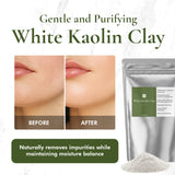 Kaolin Clay